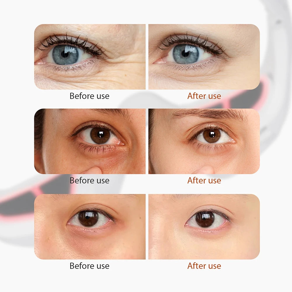 Red Light Eye Massager – Dark Circles & Fatigue Relief